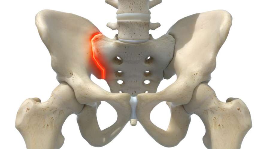 What is SI Joint Dysfunction? - CornerLoc™